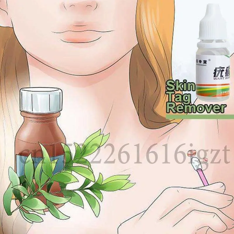 Skin Tag Mole Wart Remover