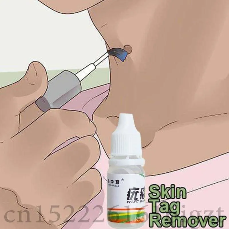 Skin Tag Mole Wart Remover